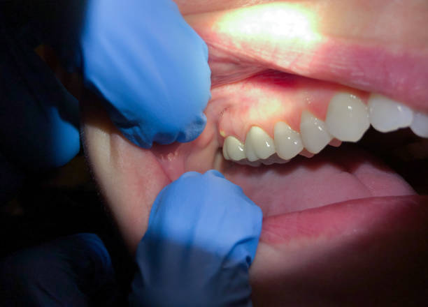 Emergency Dentist Open Today in NM