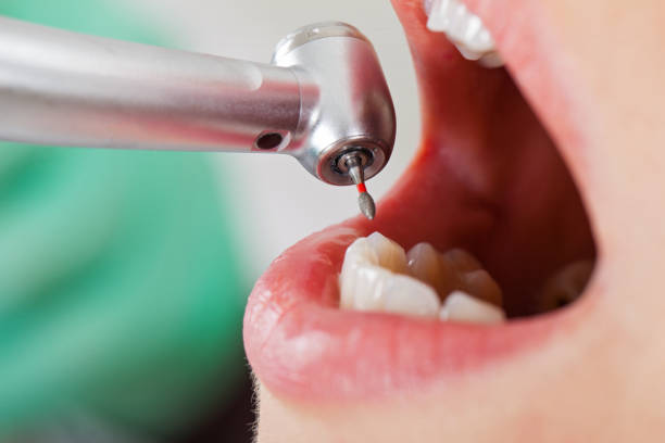 Best Cracked Tooth Emergency Dentist  in Navajo, NM